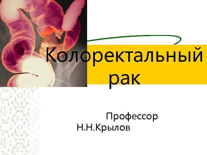 Колоректальный рак Профессор Н. Н. Крылов 