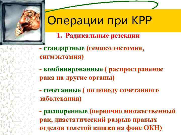Операции при КРР 1. Радикальные резекции - стандартные (гемиколэктомия, сигмэктомия) - комбинированные ( распространение