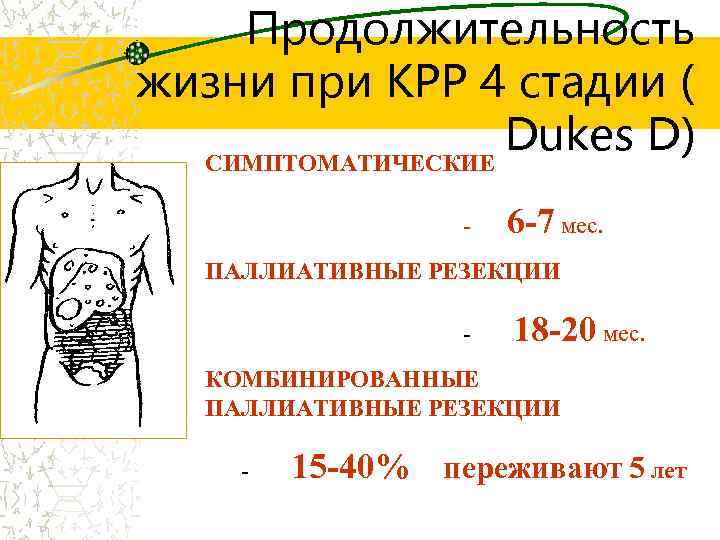 Продолжительность жизни при КРР 4 стадии ( Dukes D) СИМПТОМАТИЧЕСКИЕ - 6 -7 мес.