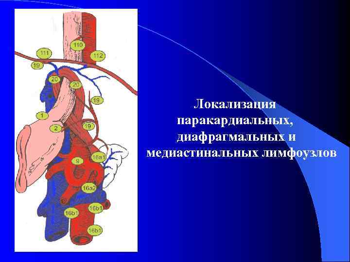 Локализация паракардиальных, диафрагмальных и медиастинальных лимфоузлов 