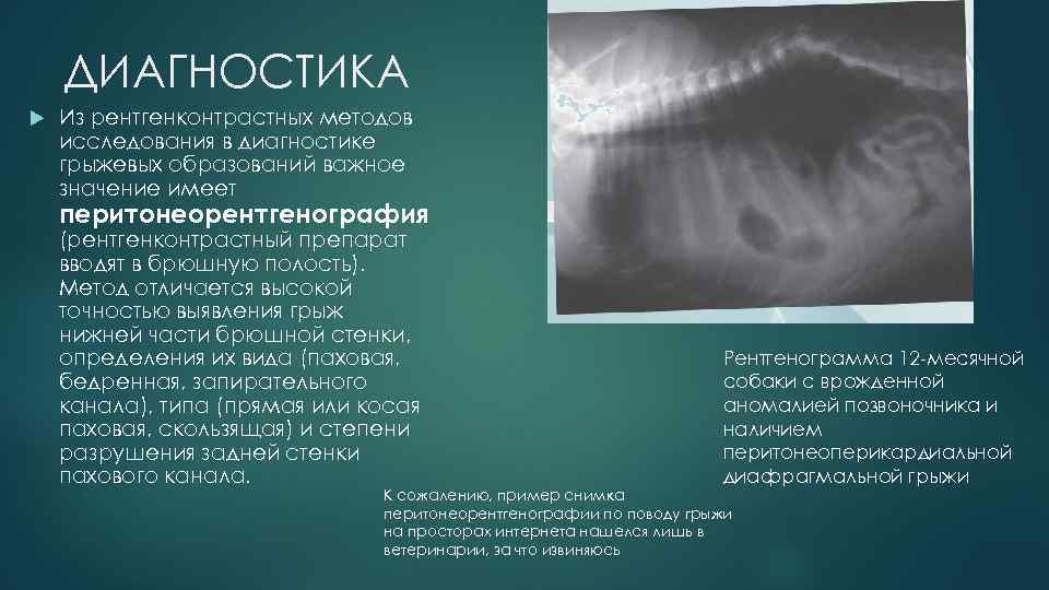 ДИАГНОСТИКА Из рентгенконтрастных методов исследования в диагностике грыжевых образований важное значение имеет перитонеорентгенография (рентгенконтрастный