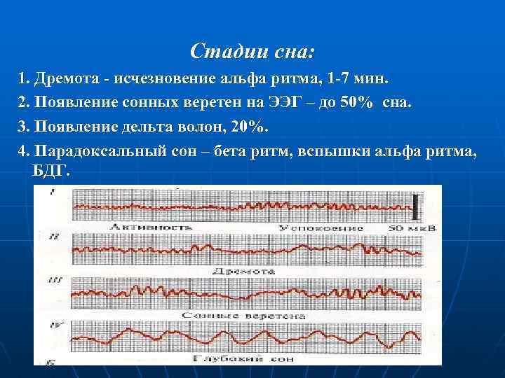 Стадии сна: 1. Дремота - исчезновение альфа ритма, 1 -7 мин. 2. Появление сонных