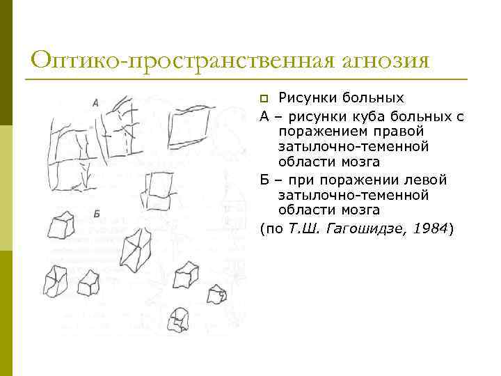 Оптико-пространственная агнозия Рисунки больных А – рисунки куба больных с поражением правой затылочно-теменной области