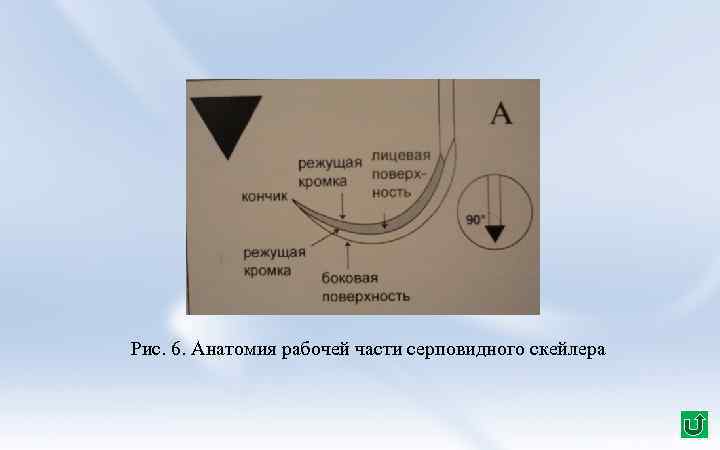 Рис. 6. Анатомия рабочей части серповидного скейлера 