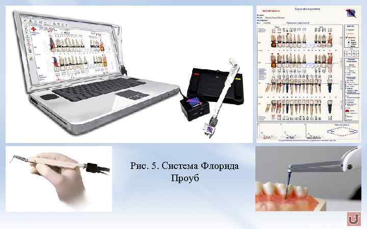 Рис. 5. Система Флорида Проуб 