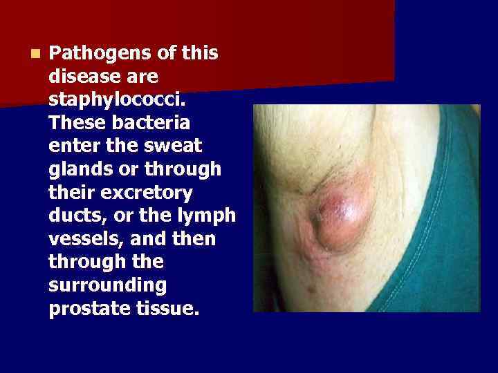 n Pathogens of this disease are staphylococci. These bacteria enter the sweat glands or