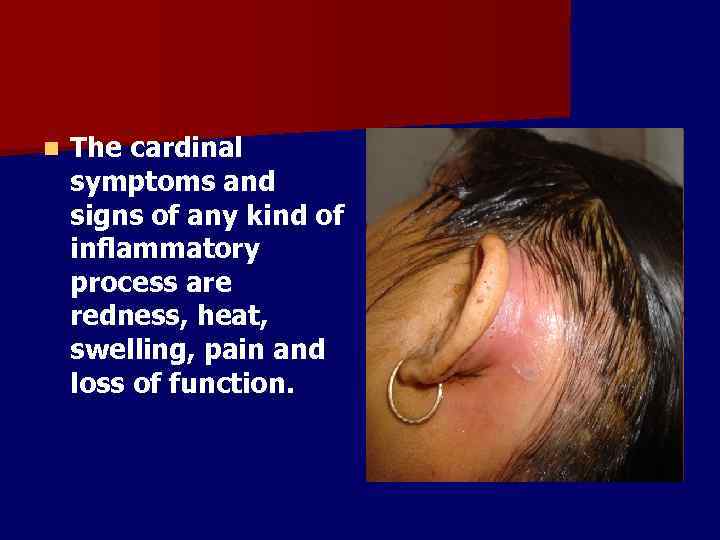 n The cardinal symptoms and signs of any kind of inflammatory process are redness,