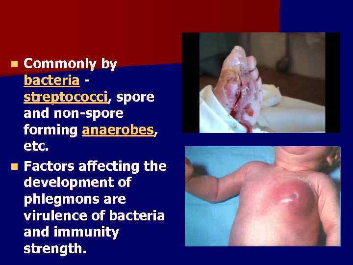 Commonly by bacteria - streptococci, spore and non-spore forming anaerobes, etc. n Factors affecting
