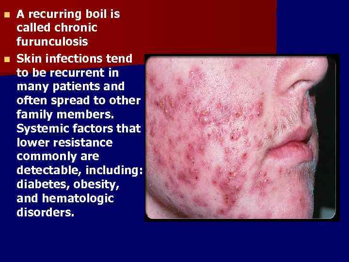 A recurring boil is called chronic furunculosis n Skin infections tend to be recurrent