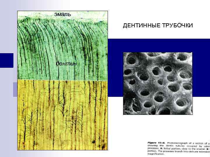 эмаль ДЕНТИННЫЕ ТРУБОЧКИ дентин 
