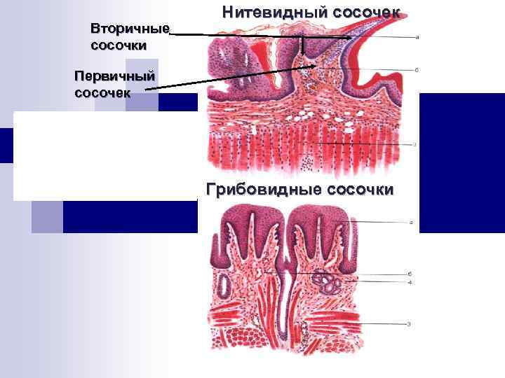 Нитевидные сосочки фото