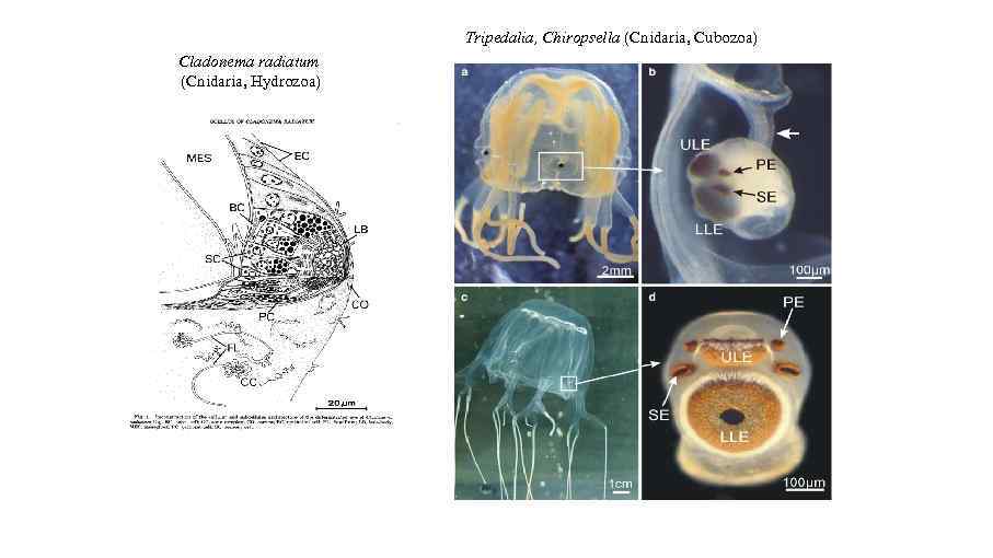Tripedalia, Chiropsella (Cnidaria, Cubozoa) Cladonema radiatum (Cnidaria, Hydrozoa) 
