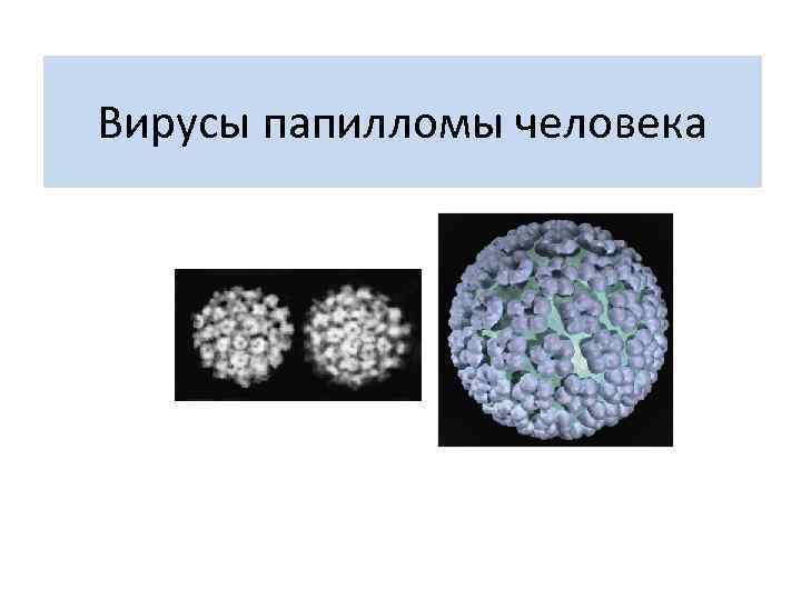 Вирусы папилломы человека 