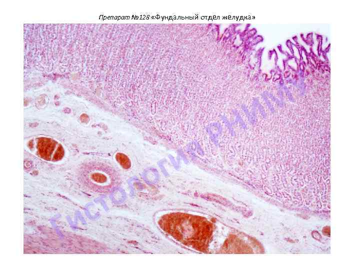 Препарат № 128 «Фундальный отдел желудка» я ги о л о т с и