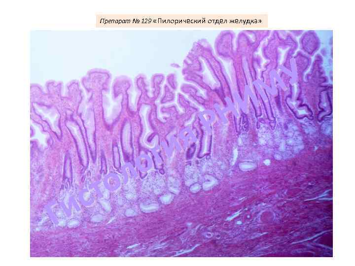 Препарат № 129 «Пилорический отдел желудка» я ги о л о ст Ги У
