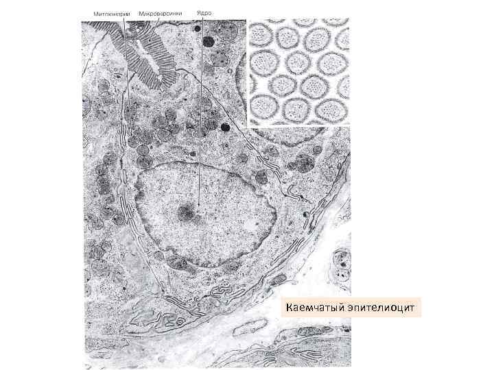 Каемчатый эпителиоцит 