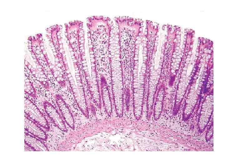 Толстая кишка рисунок гистология