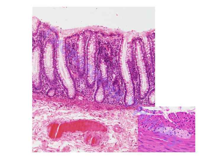 Ги ст ол ог ия РН ИМ У 