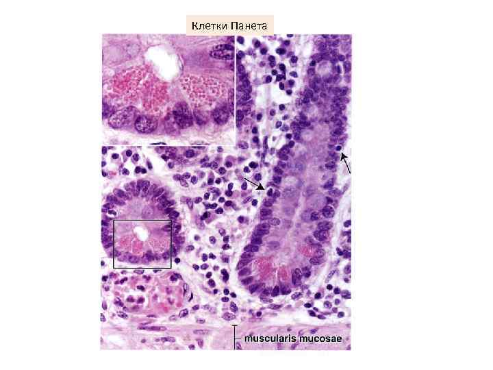 Клетки Панета 