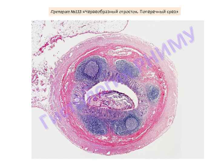 Препарат № 133 «Червеобразный отросток. Поперечный срез» я ги о л о ст и