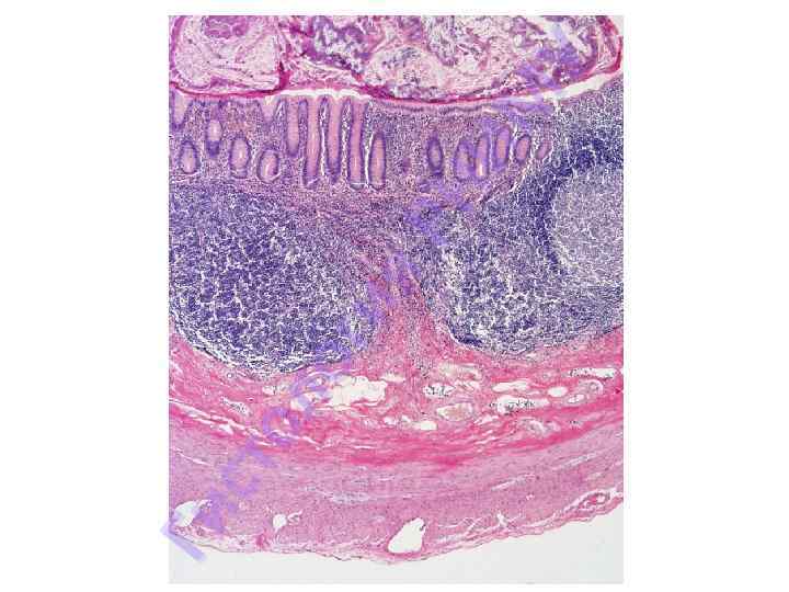 Ги сто ло ги я. Р НИ МУ 