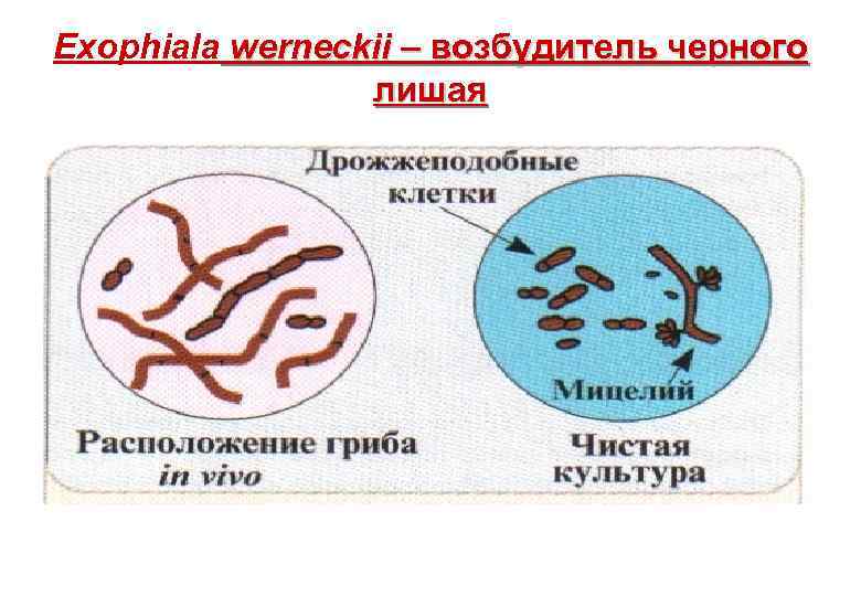 Exophiala werneckii – возбудитель черного лишая 