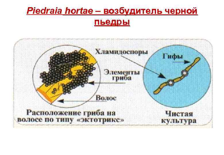 Черная пьедра фото