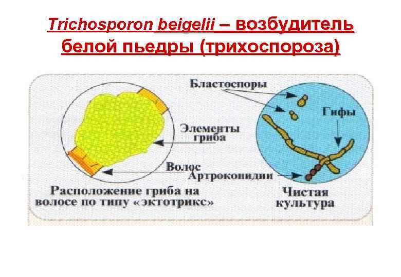 Trichosporon beigelii – возбудитель белой пьедры (трихоспороза) 