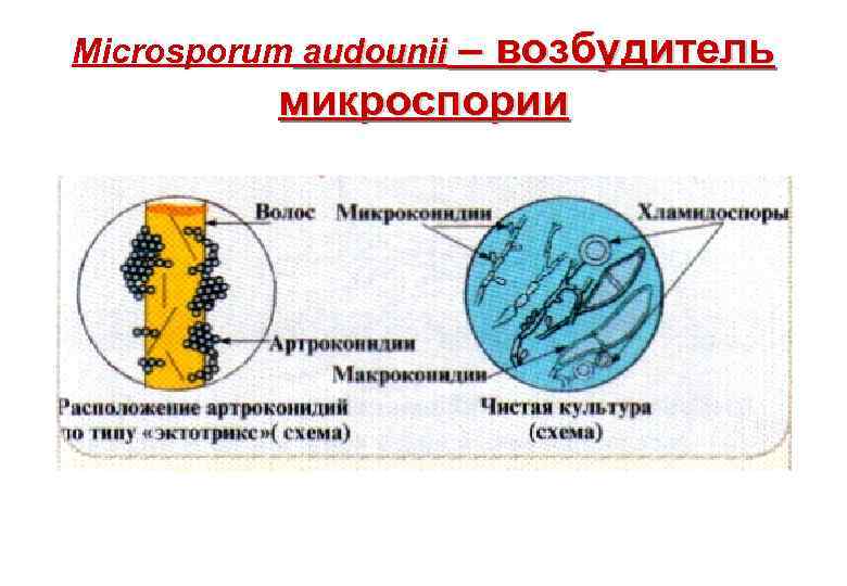 – возбудитель микроспории Microsporum audounii 