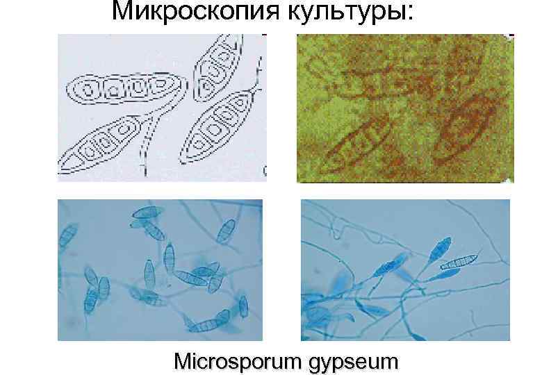 Микроскопия культуры: Microsporum gypseum 