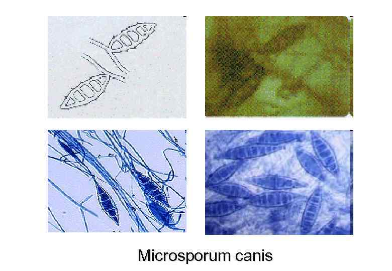 Microsporum canis. Грибом Microsporum canis. Microsporum canis микроскопия. Макроконидии microsporumcanis.. Microsporum canis колония.