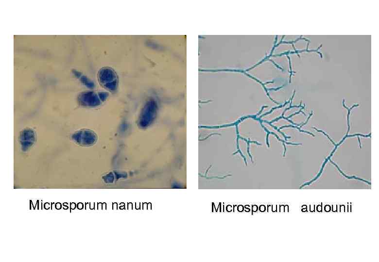 Microsporum nanum Microsporum audounii 