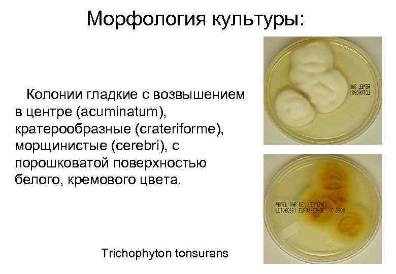 Морфология культуры: Колонии гладкие с возвышением в центре (acuminatum), кратерообразные (crateriforme), морщинистые (cerebri), с