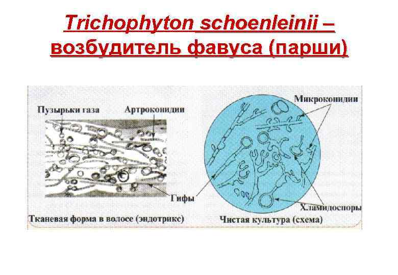 Trichophyton schoenleinii – возбудитель фавуса (парши) 