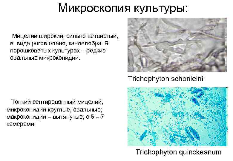 Микроскопия культуры: Мицелий широкий, сильно ветвистый, в виде рогов оленя, канделябра. В порошковатых культурах