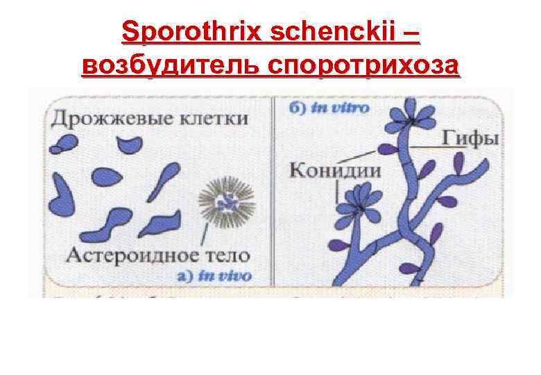 Sporothrix schenckii – возбудитель споротрихоза 