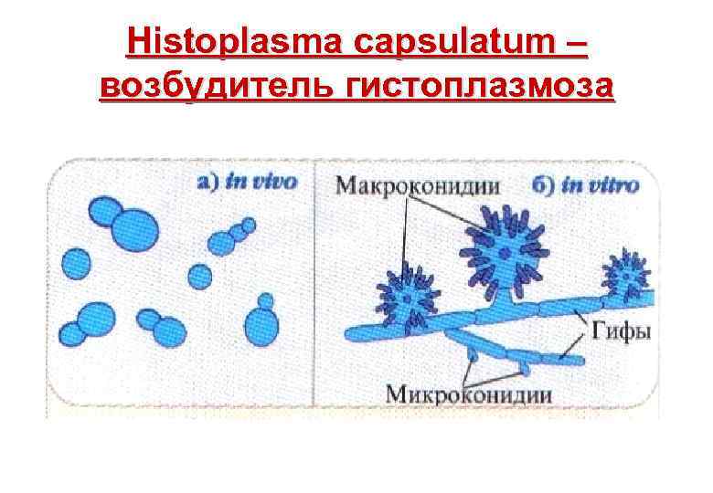Histoplasma capsulatum – возбудитель гистоплазмоза 
