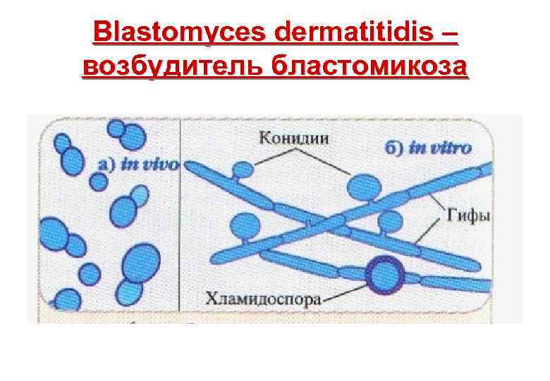 Blastomyces dermatitidis – возбудитель бластомикоза 
