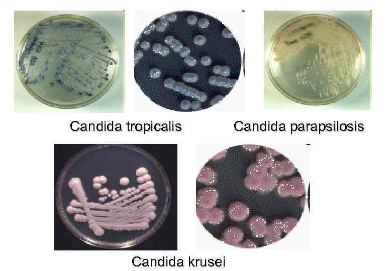 Candida tropicalis Candida krusei Candida parapsilosis.