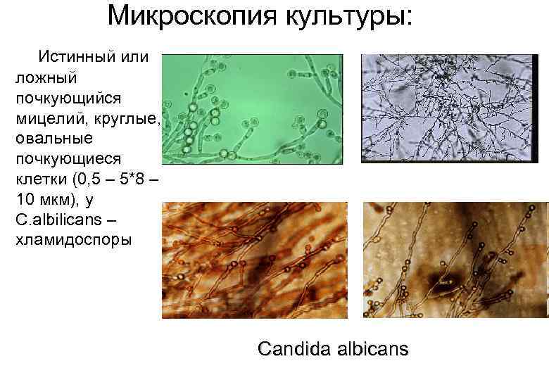 Микроскопия культуры: Истинный или ложный почкующийся мицелий, круглые, овальные почкующиеся клетки (0, 5 –