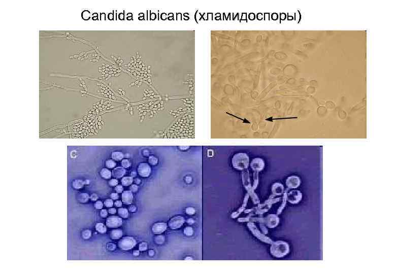 Дрожжеподобные грибы рода candida рисунок