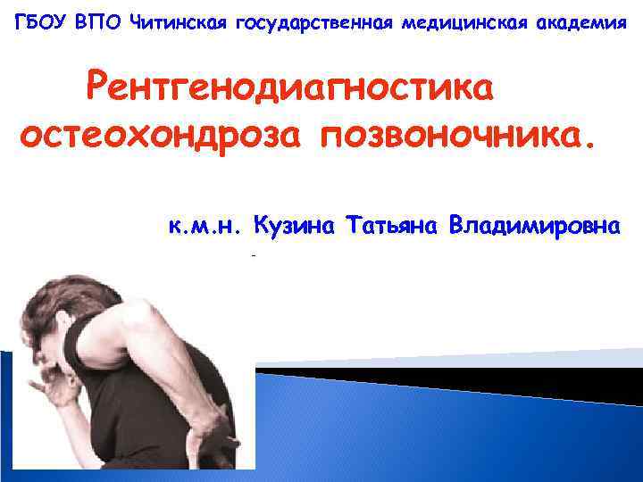ГБОУ ВПО Читинская государственная медицинская академия Рентгенодиагностика остеохондроза позвоночника. к. м. н. Кузина Татьяна