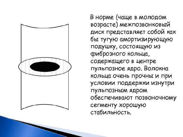  В норме (чаще в молодом возрасте) межпозвонковый диск представляет собой как бы тугую