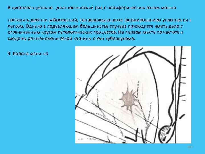 В дифференциально - диагностический ряд с периферическим раком можно поставить десятки заболеваний, сопровождающихся формированием