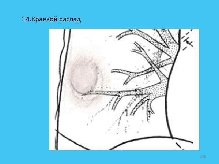 14. Краевой распад 109 