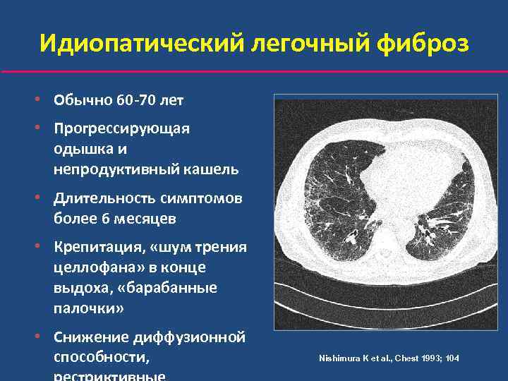 Какая рентгенологическая картина характерна для альвеолитов