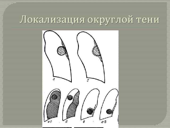  Локализация округлой тени 