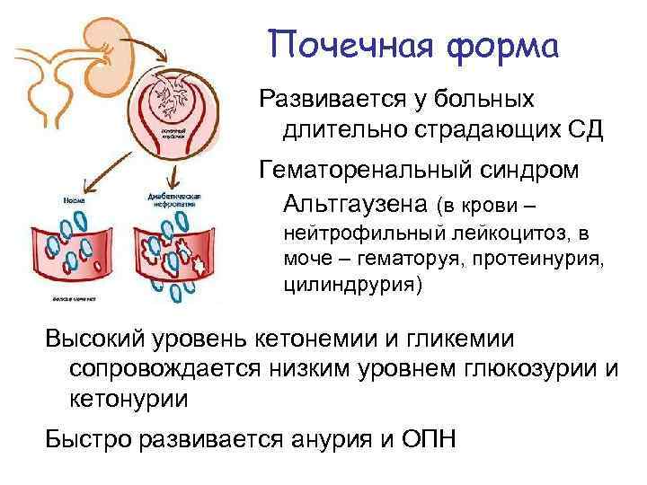Почечная форма Развивается у больных длительно страдающих СД Гематоренальный синдром Альтгаузена (в крови –