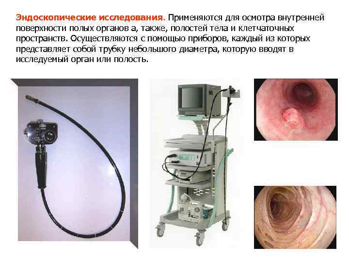 Эндоскопические исследования. Применяются для осмотра внутренней поверхности полых органов а, также, полостей тела и