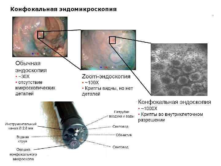 Биопсийный канал эндоскопа